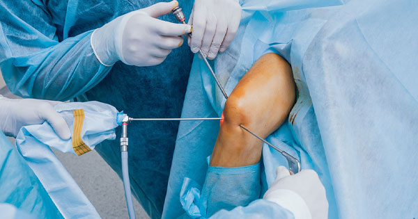 Knee arthroscopy procedure: How to prepare for knee arthroscopy